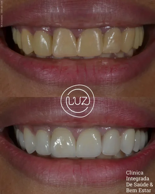 MODELO DE ANTES E DEPOIS 01