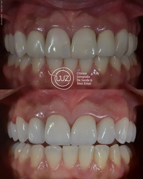 MODELO DE ANTES E DEPOIS 09